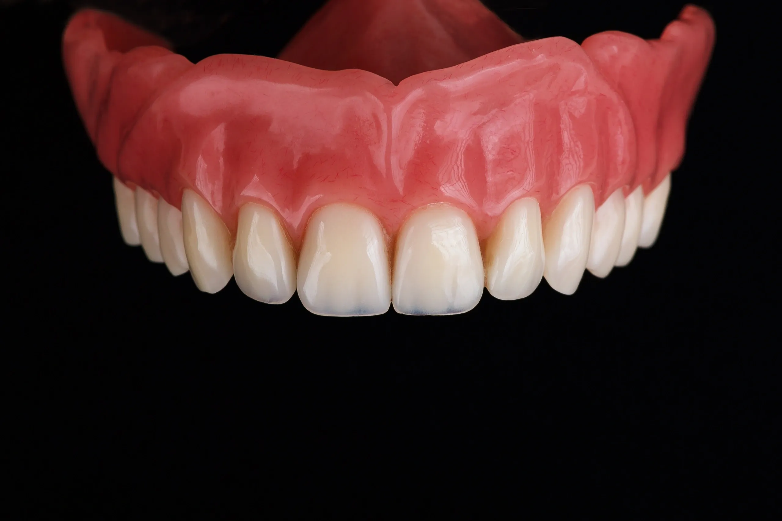 Types de prothèses dentaires - Ma santé bucco-dentaire
