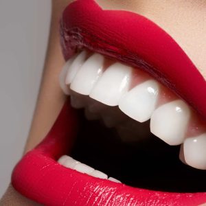 dentisterie esthétique & hollywood smile à Blida