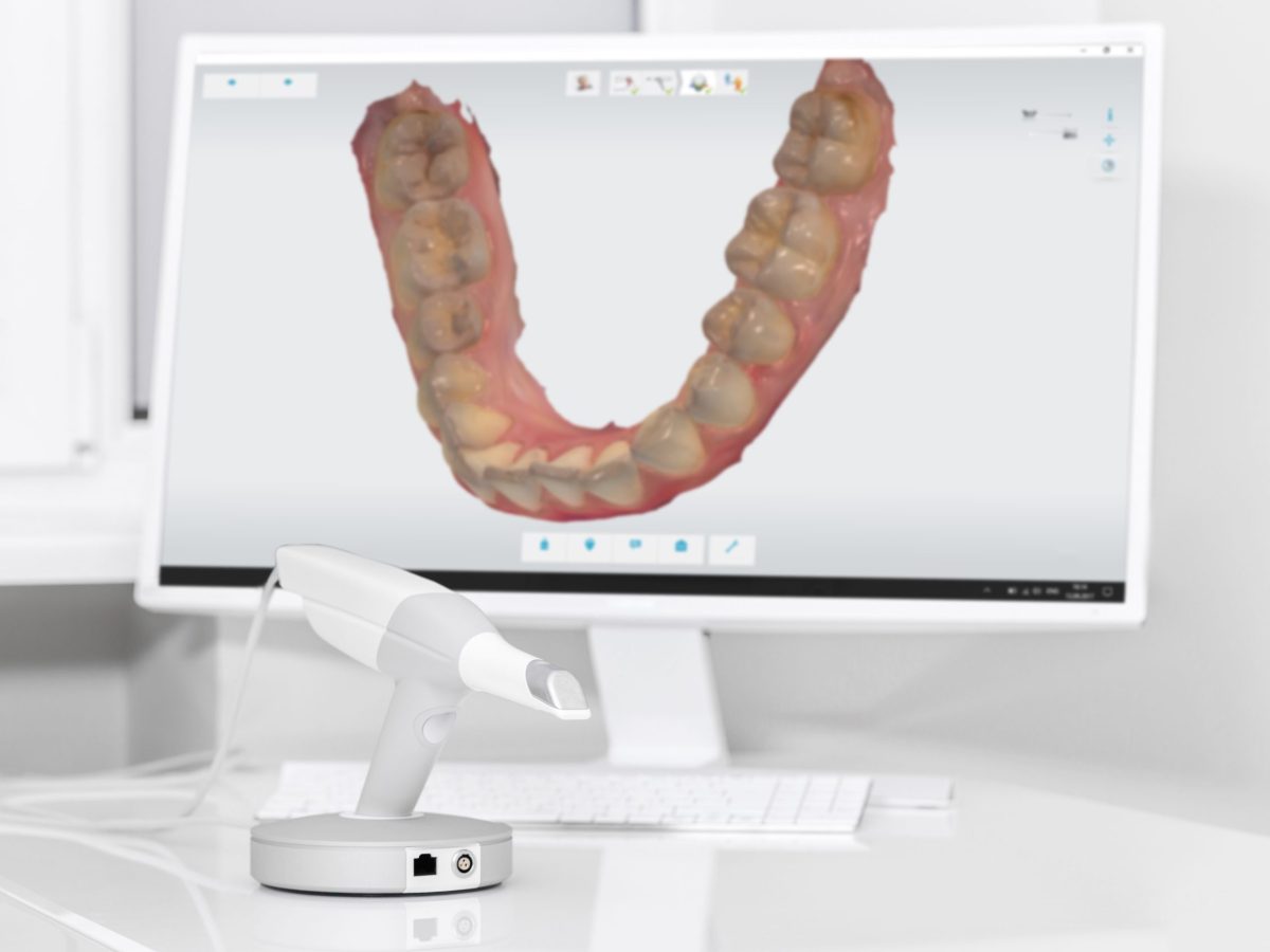 scanner-intraoral-cabinet-dentaire-blida-algerie